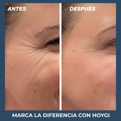 Hoygi® 2x1 - Crema Reafirmante