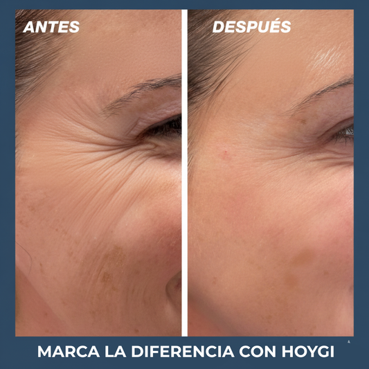 Hoygi® 2x1 - Crema Reafirmante